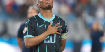 Deybi Flores alarma a la Selección Nacional, para el partido ante Costa Rica