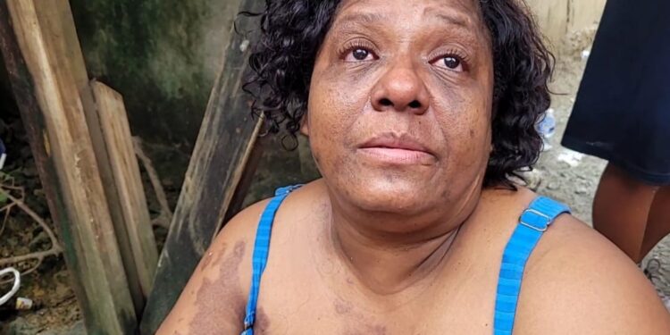 !LO PERDI TODO!! !QUEDE EN LA CALLE!! VICTIMA DE INCENDIO